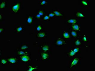 COL8A1 / Collagen VIII Alpha 1 Antibody