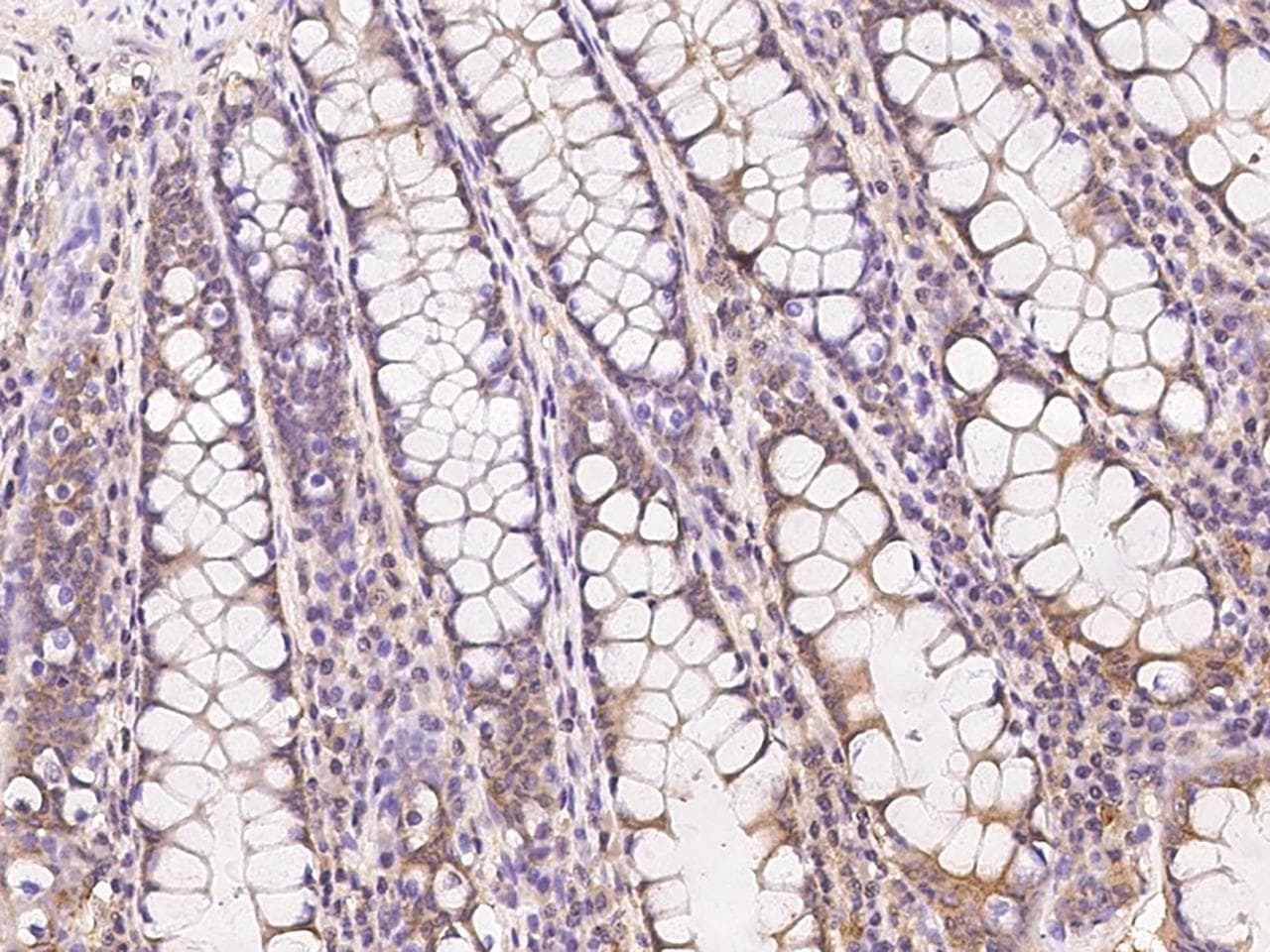 TTC12 Antibody