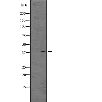 Polyclonal Rabbit anti-Human FKSG80 / GPR81 Antibody (WB)