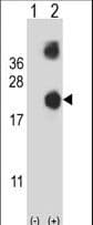 Polyclonal Rabbit anti-Human DSTN / Destrin Antibody (aa70-98, IHC, WB)