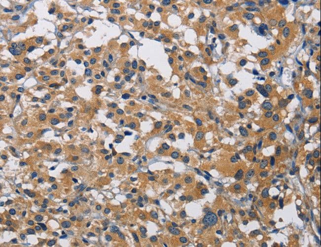 Polyclonal Rabbit anti-Human CST4 / Cystatin S Antibody (IHC)