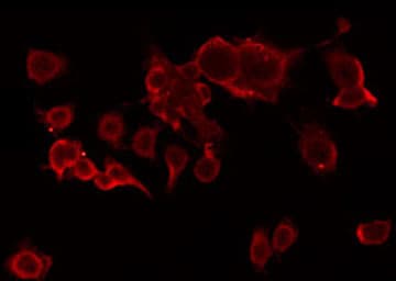 ACOT2 Antibody