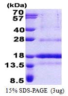 Human POLD4 Protein (Recombinant His)