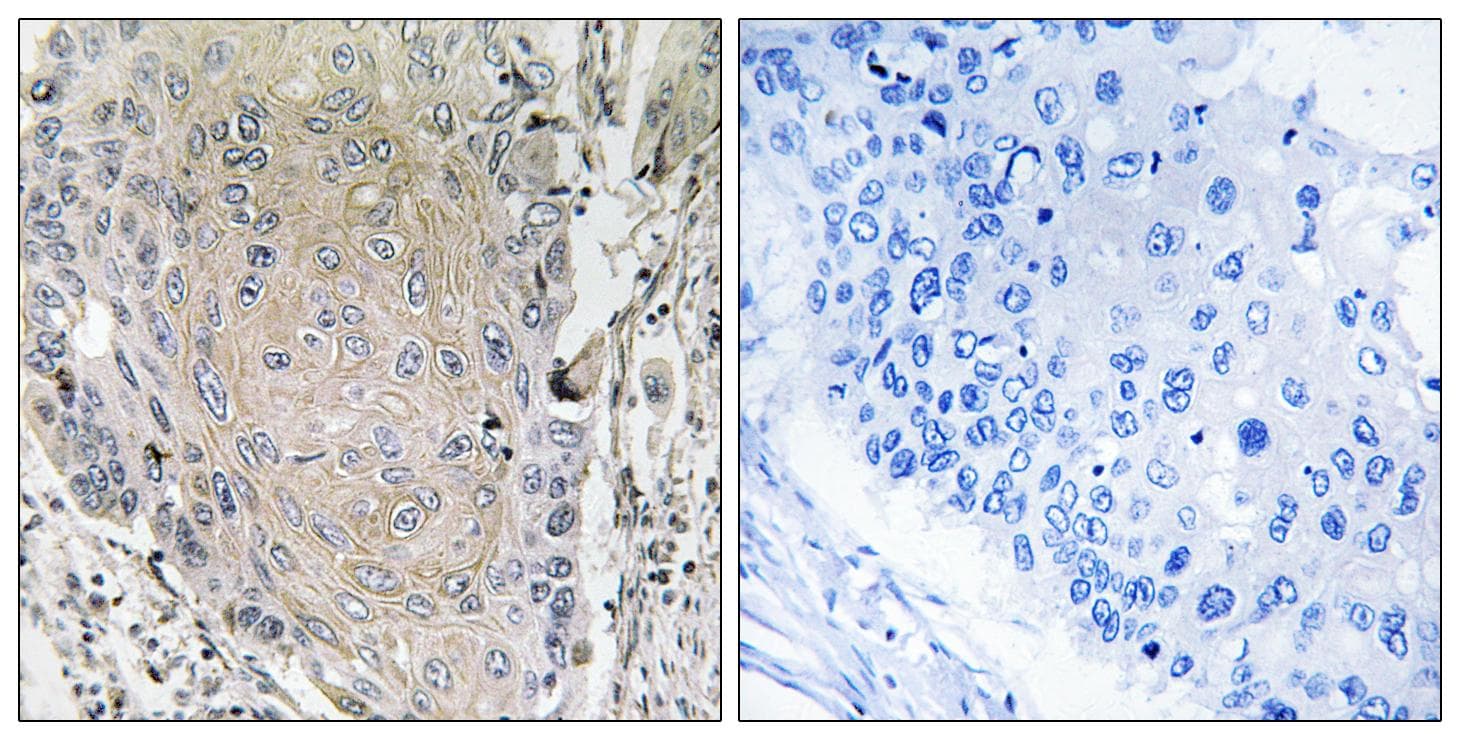 CBLN3 / Cerebellin 3 Antibody