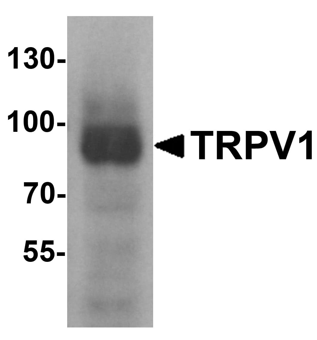 VR1 / TRPV1 Antibody
