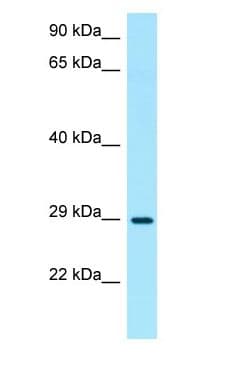 Polyclonal Rabbit anti-Human TNIP3 Antibody (aa68-117, WB)