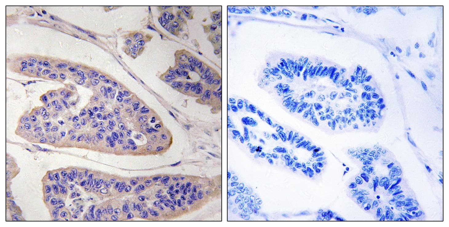 ENAH / MENA Antibody