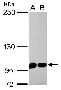 Polyclonal Rabbit anti-Human CSE1L Antibody (aa222-469, IHC, WB)