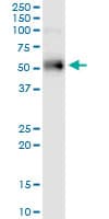 ER81 / ETV1 Antibody (clone 2A8)