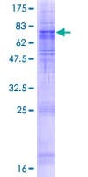 Human SEC61A2 Protein (Recombinant GST)