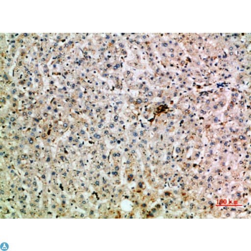 Polyclonal Rabbit anti-Human TNIP2 / ABIN-2 Antibody (IHC)