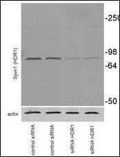 IHC-plus™ Polyclonal Rabbit anti-Human SYVN1 / HRD1 Antibody (aa586-617, IHC, IF, WB)