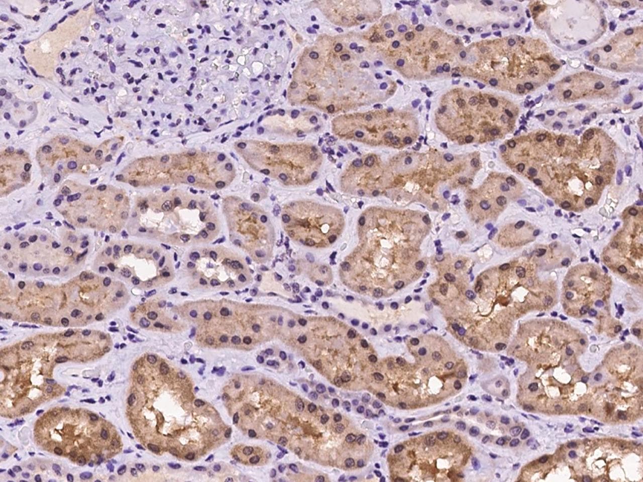 PUM2 Antibody