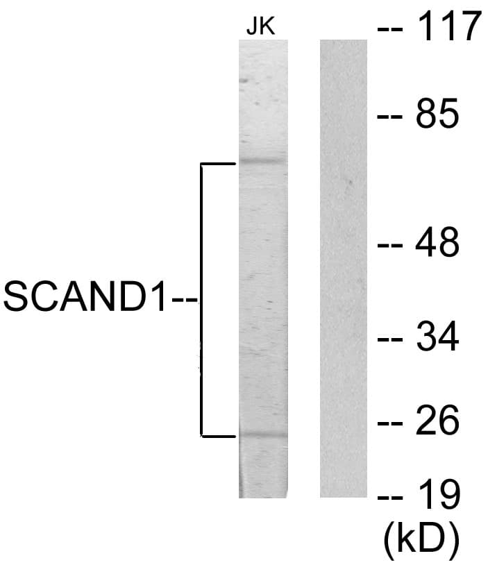 SCAND1 Antibody (aa61-110)