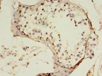 SART3 Antibody