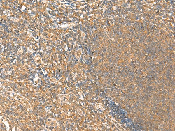 HTT / Huntingtin Antibody