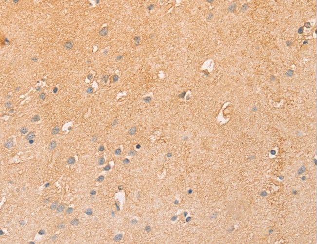 CCL16 / LEC Antibody