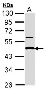 Polyclonal Rabbit anti-Human APBB3 Antibody (aa242-486, WB)