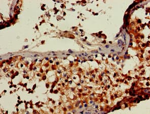 RBBP6 Antibody (aa51-97)