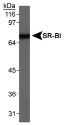 SCARB1 / SR-BI Antibody