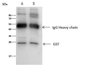 GSTP1 / GST Pi Antibody (Preservative Free)