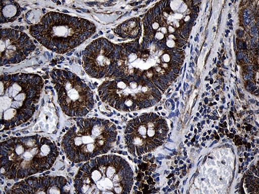 PCCA Antibody (clone OTI1E9)