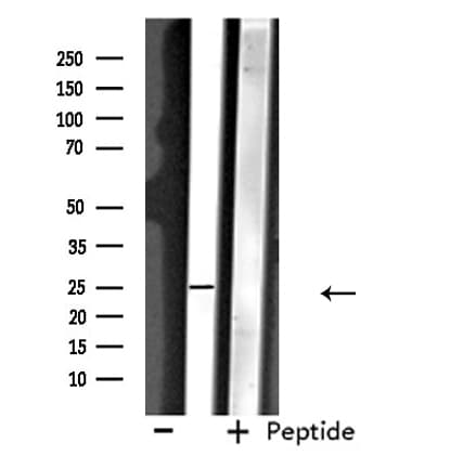 NDFIP1 / N4WBP5 Antibody