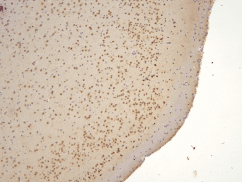 TAF12 Antibody
