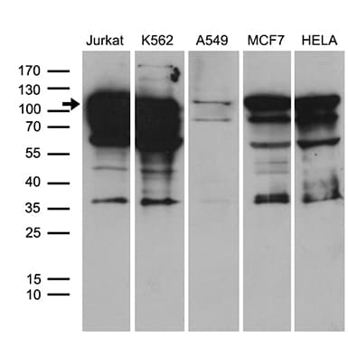 TCF12 / HEB Antibody (clone OTI1F11)