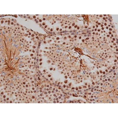 SP1 Antibody (phospho-Thr453)