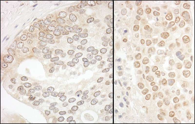 Polyclonal Rabbit anti-Human DTL / CDT2 Antibody (aa680-C-term, IHC, WB)