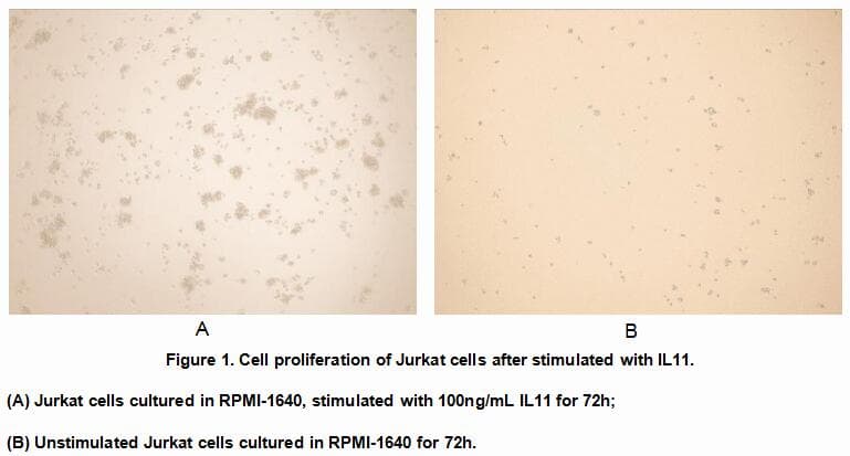Human IL1R1 Protein (Recombinant His, N-Terminal)