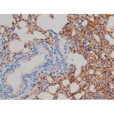 IGF1R / IGF1 Receptor Antibody (phospho-Tyr1161)