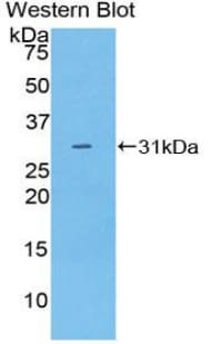 MUSK Antibody (aa517-777)