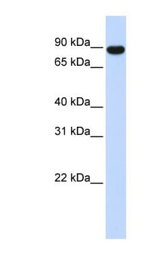 Polyclonal Rabbit anti-Human AKAP8 / AKAP95 Antibody (aa576-625, WB)
