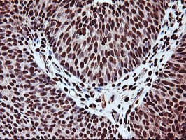Monoclonal Mouse anti-Human SAMHD1 Antibody (clone OTI2A5, IHC, IF, WB)
