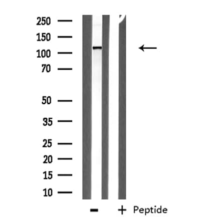 Polyclonal Rabbit anti-Human ITPKB Antibody (IF, WB)