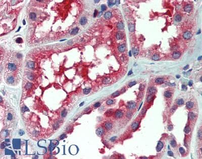 IHC-plus™ TFG Antibody (aa175-225)