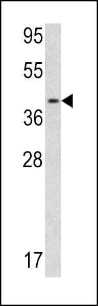 Polyclonal Rabbit anti-Human CNN3 Antibody (aa129-158, IHC, WB)
