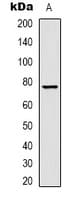 TF / Transferrin Antibody