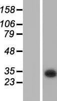 KCTD6 Protein (Over-Expression Lysate Myc-DDK (Flag))