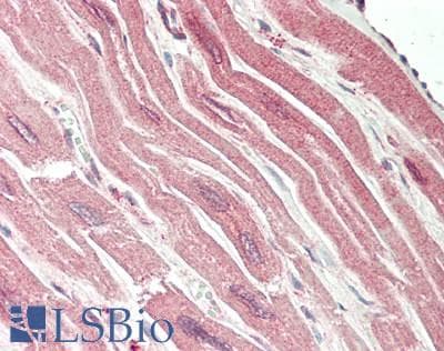 Polyclonal Rabbit anti-Human PVRL3 / Nectin-3 Antibody (aa467-516, IHC, WB)