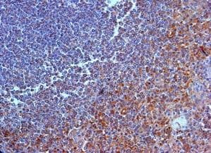 IL23R Antibody (aa59-87)