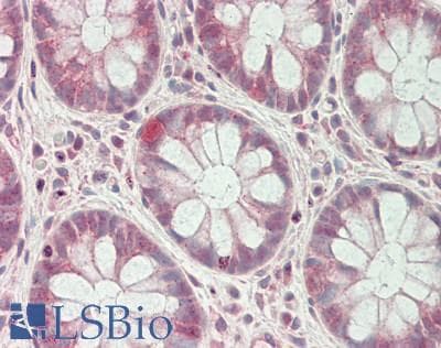 GLTSCR1 Antibody (aa1189-1238)
