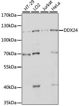 Polyclonal Rabbit anti-Human DDX24 Antibody (WB)