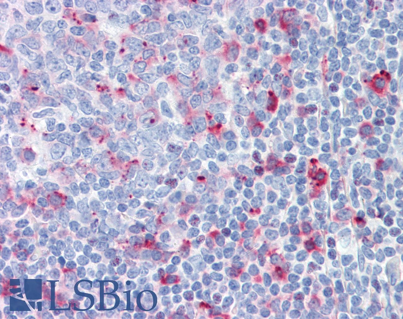 IHC-plus™ Monoclonal Mouse anti-Human CTSC / Cathepsin C / JP Antibody (IHC, WB)