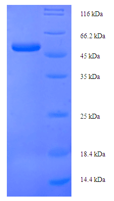 Human WNT4 Protein (Recombinant His-SUMO)