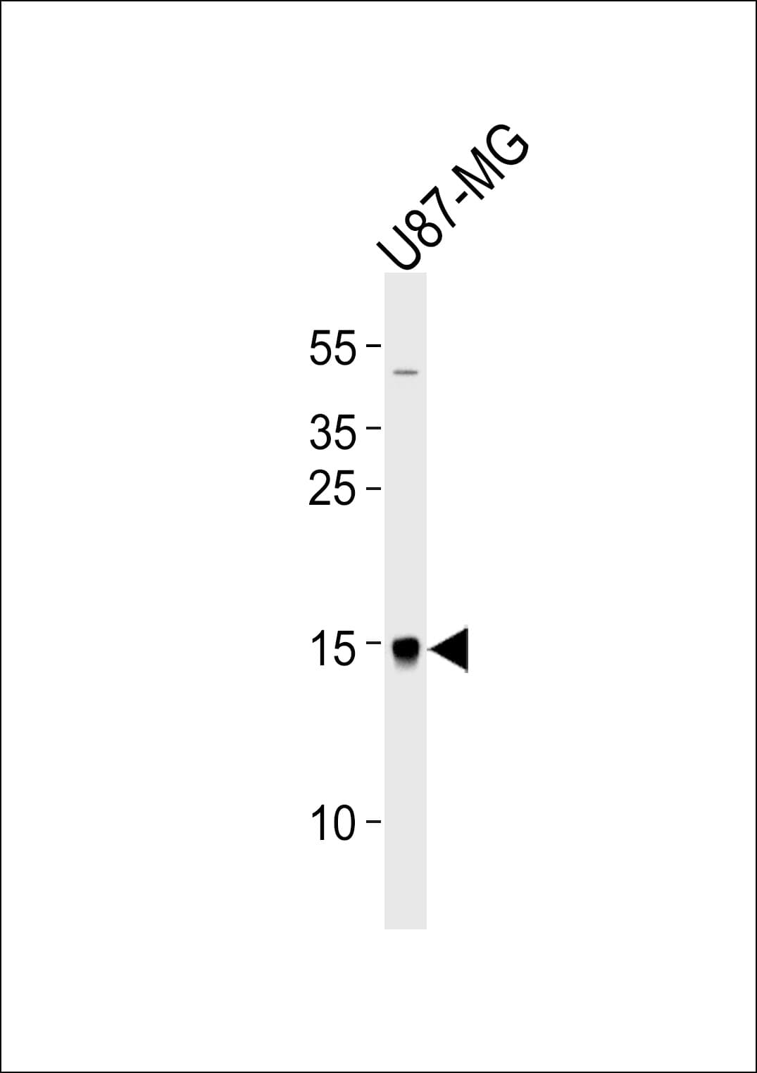 MAP1LC3A / LC3A Antibody (aa100-141)