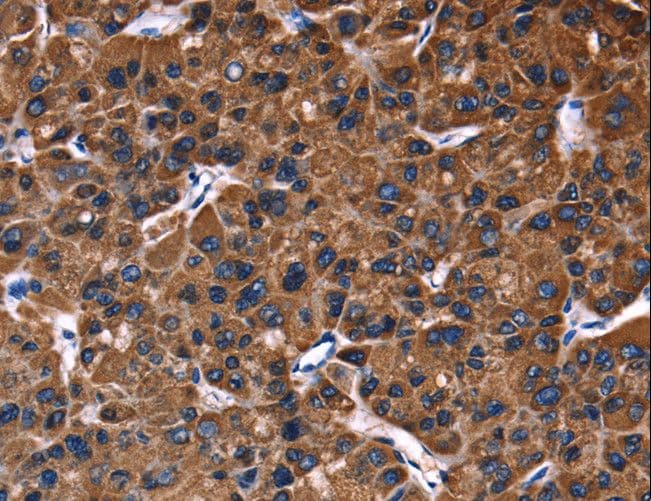 PHB / Prohibitin Antibody