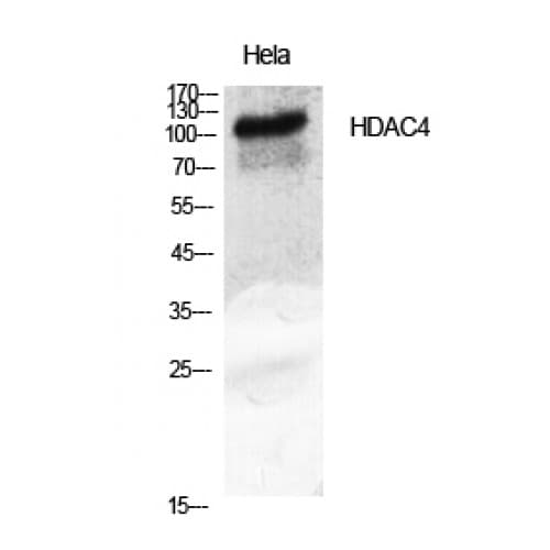 Polyclonal Rabbit anti-Human HDAC4 Antibody (570-650 aa, WB)